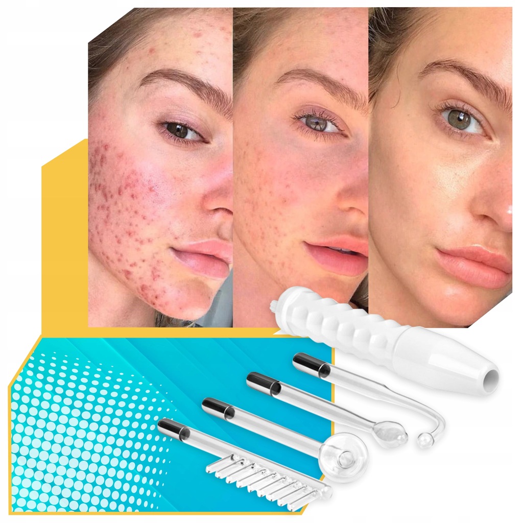 DERMA WAND PRO darsonval 4 elektrody peloty najmocniejszy do skóry twarzy Marka Lewer